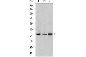 Western blot analysis using PINCH mouse mAb against A549 (1), Jurkat (2), and Hela (3) cell lysate.