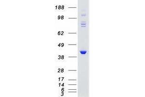 Validation with Western Blot