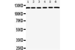 Western Blotting (WB) image for anti-Coxsackie Virus and Adenovirus Receptor (CXADR) (AA 313-328), (C-Term) antibody (ABIN3044083) (Coxsackie Adenovirus Receptor anticorps  (C-Term))