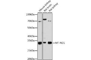 Western blot analysis of extracts of various cell lines, using MT-ND1 antibody (ABIN7268597) at 1:1000 dilution. (MT-ND1 anticorps)