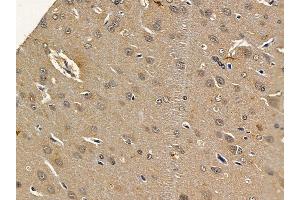 ABIN7093774 and ABIN7097815 at 1/100 staining rat brain tissue by IHC-P. (DDIT3 anticorps  (N-Term))