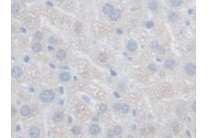 DAB staining on IHC-P; Samples: Mouse Liver Tissue