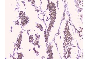 IHC analysis of TNFRSF11B using anti-TNFRSF11B antibody (ABIN7600875).