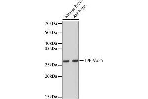 Western blot analysis of extracts of various cell lines, using TPPP/p25 Rabbit mAb (ABIN7271031) at 1:5000 dilution. (Tppp anticorps)