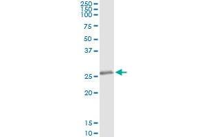 Immunoprecipitation of KCNIP3 transfected lysate using anti-KCNIP3 monoclonal antibody and Protein A Magnetic Bead , and immunoblotted with KCNIP3 MaxPab rabbit polyclonal antibody. (DREAM anticorps  (AA 1-256))