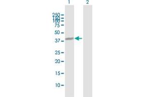 anti-Nuclear Fragile X Mental Retardation Protein Interacting Protein 1 (NUFIP1) (AA 1-276) antibody