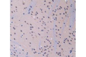Used in DAB staining on fromalin fixed paraffin- embedded brain tissue (IL12A anticorps  (AA 23-215))