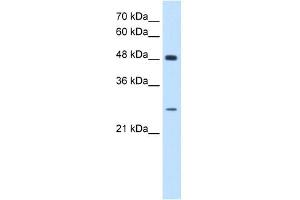 SH3BGR antibody used at 0. (SH3BGR anticorps  (N-Term))