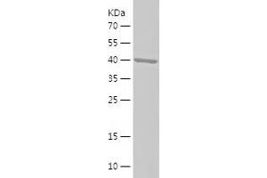 Western Blotting (WB) image for Complement Component 8, alpha Polypeptide (C8A) (AA 195-374) protein (His-IF2DI Tag) (ABIN7122471)