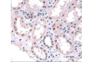 IHC-P analysis of Human Tissue, with DAB staining. (p300 anticorps  (AA 1351-1601))