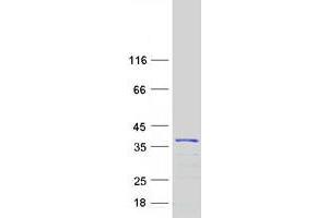 Validation with Western Blot