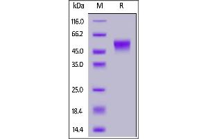 Human CD16b (NA2), SUMO,His Tag on  under reducing (R) condition.