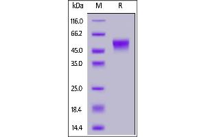 Human CD16b (NA2), SUMO,His Tag on  under reducing (R) condition. (FCGR3B Protein (AA 17-200) (His tag,SUMO Tag))