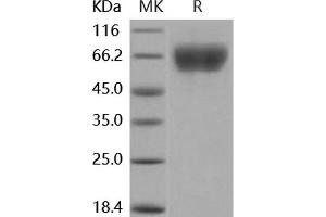 Western Blotting (WB) image for Fibroblast Growth Factor Receptor 3 (FGFR3) (Active) protein (His tag) (ABIN7320453)