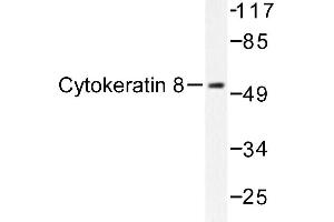 Image no. 1 for anti-Keratin 8 (KRT8) antibody (ABIN272030) (KRT8 anticorps)