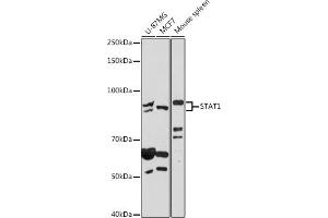 Western blot analysis of extracts of various cell lines, using ST antibody (ABIN6128749, ABIN6148564, ABIN6148566 and ABIN6215937) at 1:500 dilution. (STAT1 anticorps  (AA 513-712))