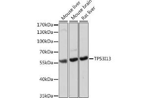 Western blot analysis of extracts of various cell lines, using TP53I13 antibody (ABIN7271098) at 1:1000 dilution. (TP53I13 anticorps  (AA 180-310))