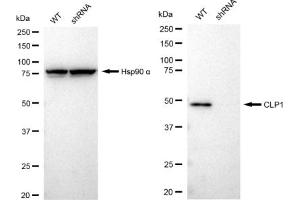 Western blotting analysis using CLP1 antibody (ABIN7798094).