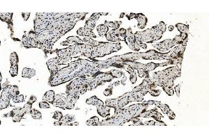 IHC analysis of HNRNPH3 using anti-HNRNPH3 antibody (ABIN7601121).