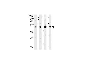 MEK1 Antibody (M1) (ABIN1882177 and ABIN2842020) western blot analysis in Jurkat,PC-12,rat C6 cell line and mouse brain lysates (35 μg/lane). (MEK1 anticorps  (N-Term))