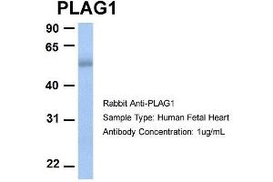 Host:  Rabbit  Target Name:  PLAG1  Sample Type:  Human Fetal Heart  Antibody Dilution:  1. (PLAG1 anticorps  (N-Term))