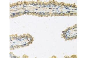Immunohistochemistry of paraffin-embedded Human prostate using CRHBP Polyclonal Antibody at dilution of 1:100 (40x lens). (CRHBP anticorps)