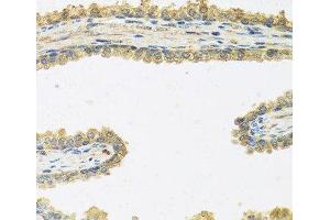 Immunohistochemistry of paraffin-embedded Human prostate using CRHBP Polyclonal Antibody at dilution of 1:100 (40x lens).