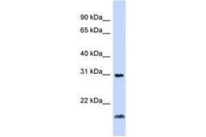 Image no. 1 for anti-Tumor Necrosis Factor (Ligand) Superfamily, Member 14 (TNFSF14) (C-Term) antibody (ABIN6744345) (TNFSF14 anticorps  (C-Term))