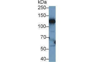 Detection of CP in Human Liver lysate using Polyclonal Antibody to Ceruloplasmin (CP)