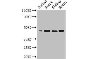 Western Blot Positive WB detected in: Jurkat whole cell lysate, Mouse heart tissue, Mouse kidney tissue, Mouse brain tissue All lanes: DOK2 antibody at 3. (DOK2 anticorps  (AA 123-412))