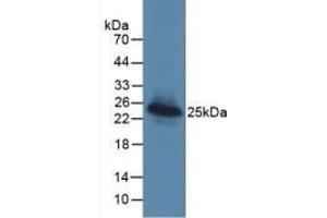 Detection of Recombinant LGALS3BP, Human using Monoclonal Antibody to Lectin Galactoside Binding, Soluble 3 Binding Protein (LGALS3BP)