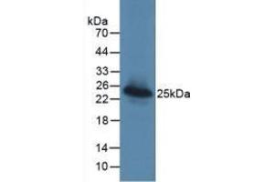 Detection of Recombinant LGALS3BP, Human using Monoclonal Antibody to Lectin Galactoside Binding, Soluble 3 Binding Protein (LGALS3BP) (LGALS3BP anticorps  (AA 24-221))