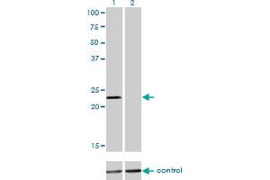 Western blot analysis of DENR over-expressed 293 cell line, cotransfected with DENR Validated Chimera RNAi (Lane 2) or non-transfected control (Lane 1). (Density Regulated Protein anticorps  (AA 1-81))