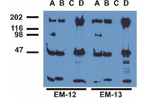 Immunoprecipitation ofEGFR from EGF-treated A431 cells by monoclonal antibodies EM-12 (A), (B), a commercial anti-EGFR polyclonal antibody (C)and anti-EGFR monoclonal mAb108 (D). (EGFR anticorps  (Tyr1173))