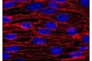 Image no. 1 for anti-Cadherin 5 (CDH5) antibody (ABIN960570)