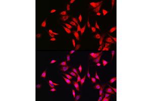 Immunofluorescence analysis of NIH/3T3 cells using SOD1 Rabbit pAb (ABIN3020854, ABIN3020855, ABIN3020856 and ABIN6213758) at dilution of 1:150 (40x lens). (SOD1 anticorps  (AA 1-154))