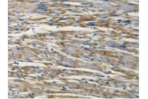 Figure. (PSMC4 anticorps  (AA 1-418))