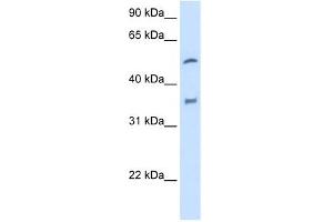 CYP2D6 antibody used at 2.