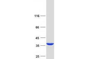 Validation with Western Blot