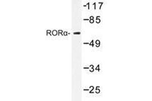 Western blot analysis of RORα antibody in extracts from HeLa cells. (RORA anticorps)