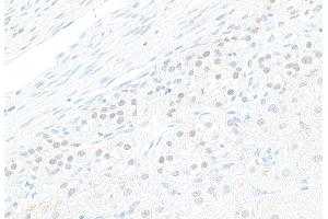 Immunohistochemistry (IHC) image for anti-GATA Binding Protein 4 (GATA4) (AA 392-442) antibody (ABIN7453878) (GATA4 anticorps  (AA 392-442))