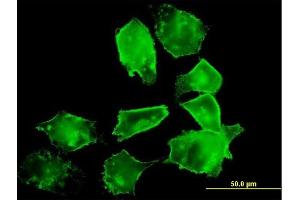 Immunofluorescence of purified MaxPab antibody to DAF on HeLa cell.