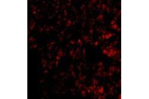 Immunofluorescence of Blimp-1 in mouse lung tissue with AP30154PU-N Blimp-1 antibody at 20 μg/ml.