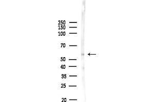 Western blot analysis of lysates from Mouse brain, using ACV1B Antibody at 1/1000 dilution.