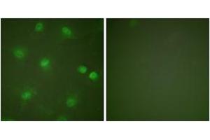 Immunofluorescence analysis of HeLa cells, using MEF2A (Ab-408) Antibody.