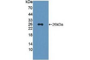 Detection of Recombinant PSMD5, Human using Polyclonal Antibody to Proteasome 26S Subunit, Non ATPase 5 (PSMD5) (Proteasome 26S Subunit, Non ATPase 5 (AA 143-341) anticorps)