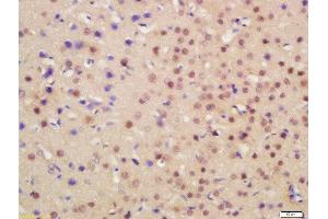 Formalin-fixed and paraffin embedded mouse brain labeled with Rabbit Anti-HRG beta 1 Polyclonal Antibody, Unconjugated  at 1:200 followed by conjugation to the secondary antibody and DAB staining (Hrg beta 1 (AA 65-150) anticorps)