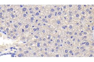 Detection of TNFa in Mouse Liver Tissue using Polyclonal Antibody to Tumor Necrosis Factor Alpha (TNFa)