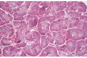 Image no. 2 for anti-Phospholipid Transfer Protein (PLTP) (C-Term) antibody (ABIN6749777) (PLTP anticorps  (C-Term))