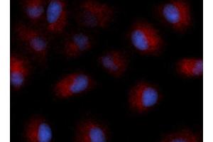 Immunofluorescence (IF) image for anti-Tetraspanin 26 (TSPAN26) (AA 112-241) antibody (APC) (ABIN5566694) (CD37 anticorps  (AA 112-241) (APC))
